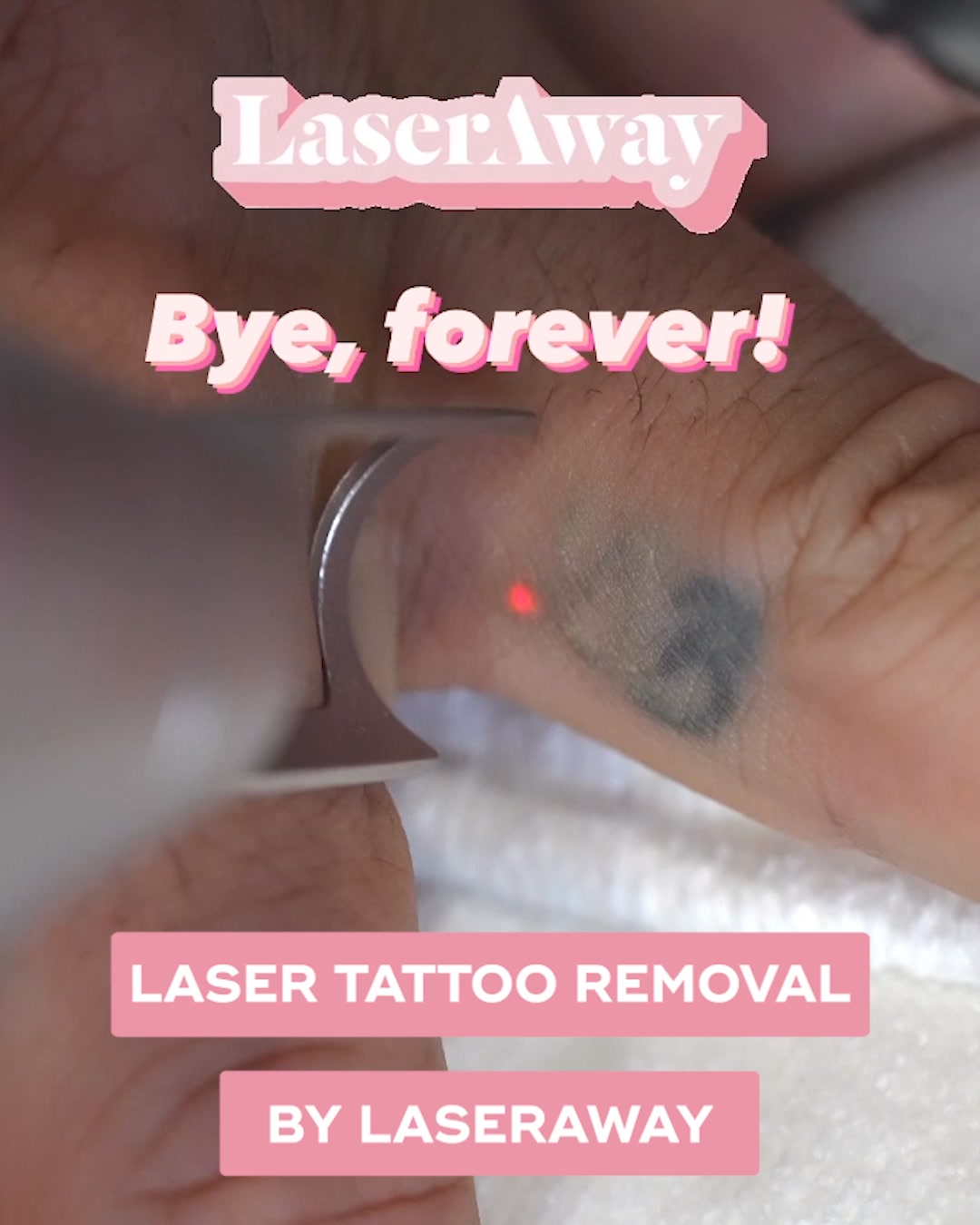 LaserAway Facebook ad: Erase Unwanted Ink