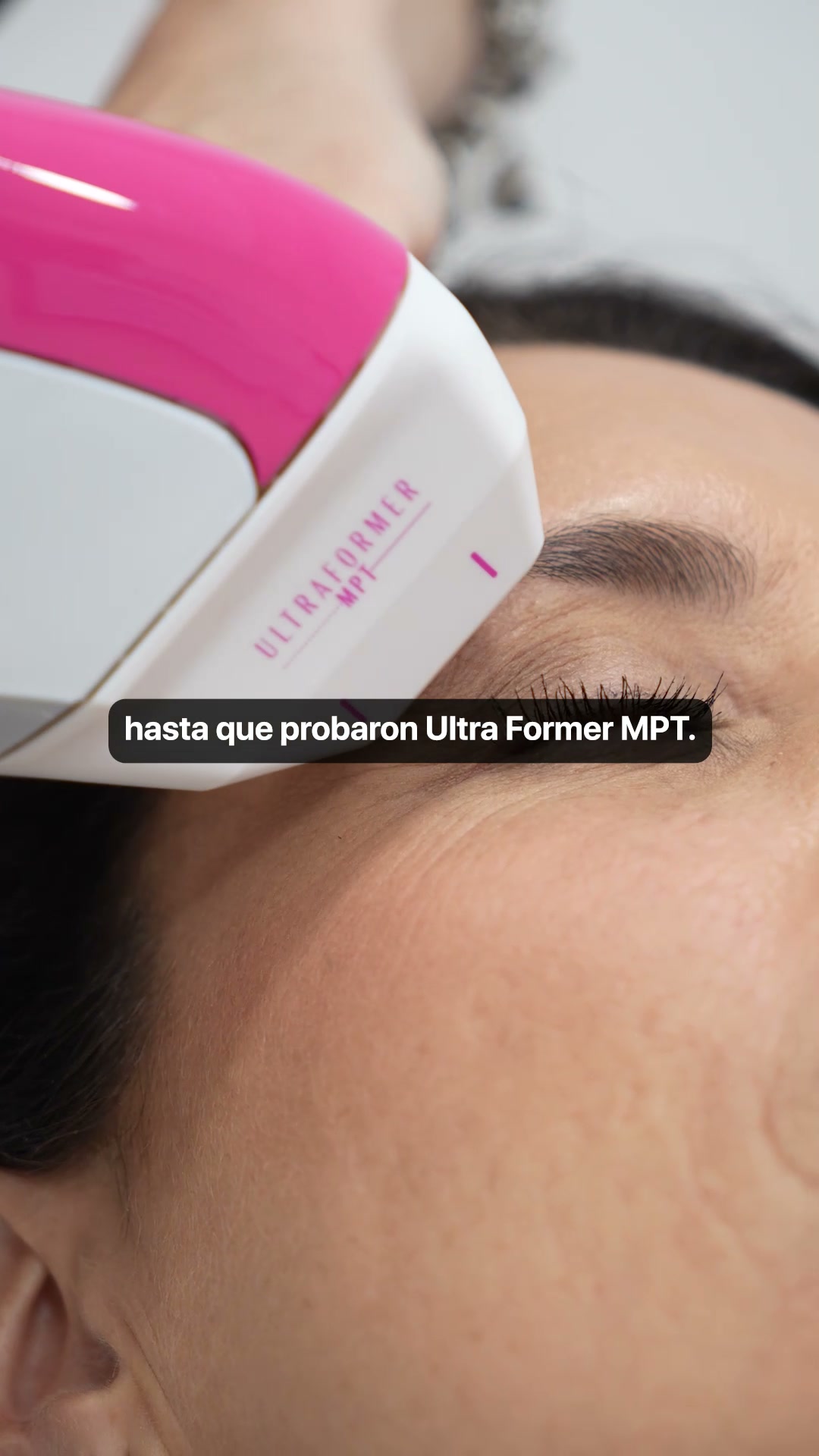 Dermacenter Dermatólogos Facebook ad: Consigue un efecto lifting con nuestro tratamiento…