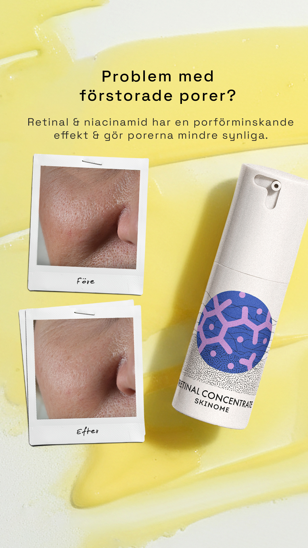 Skinome Facebook ad