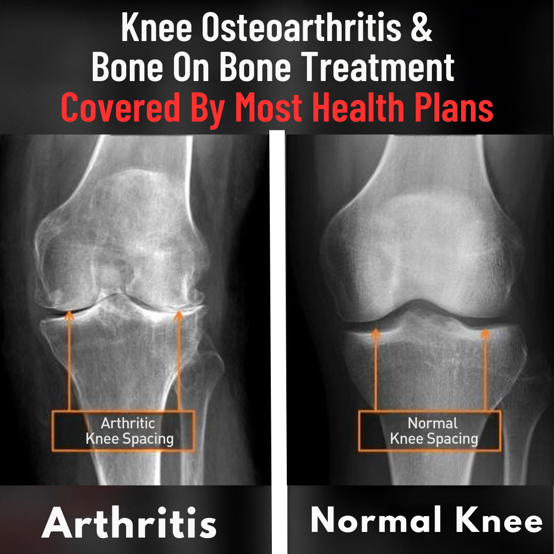 True Wellness Integrated Medicine Facebook ad: Knee Pain? Try Our Non-Surgical Solutions in Chattanooga!