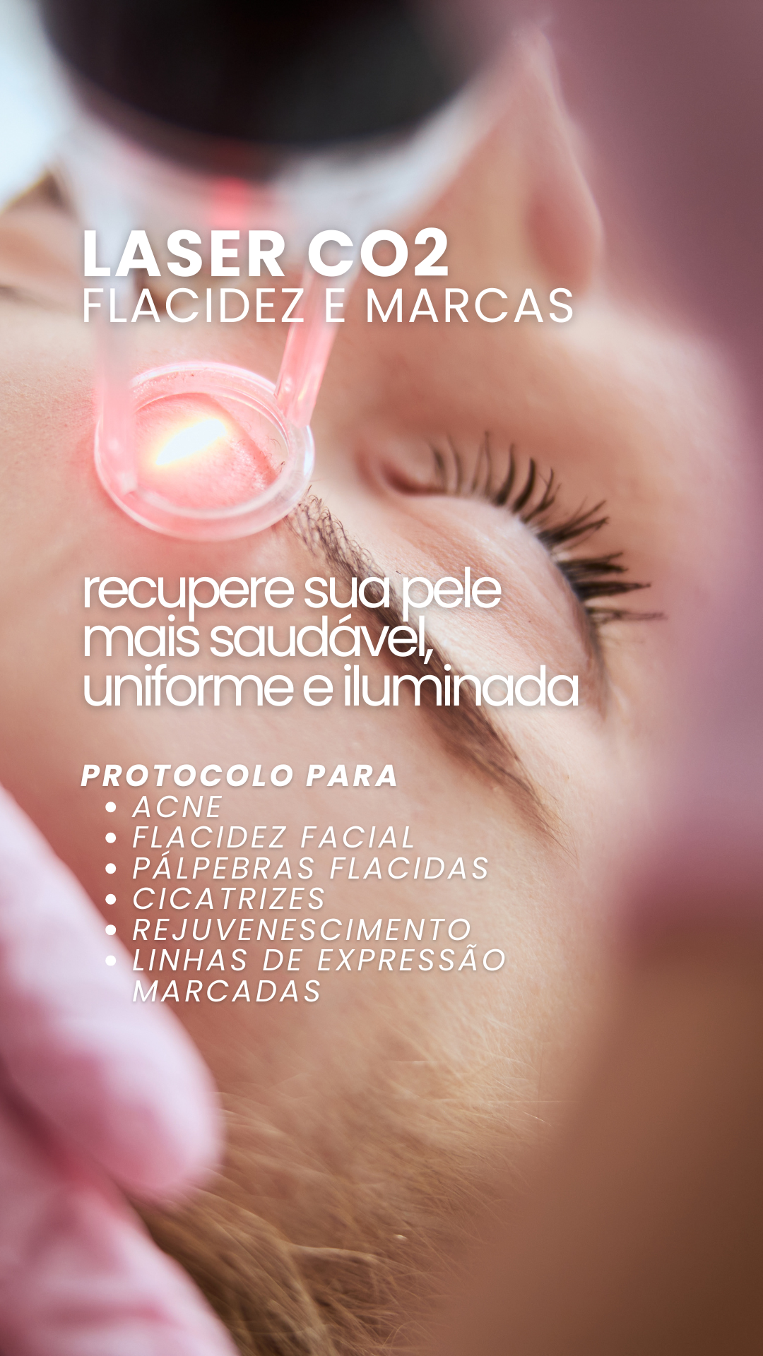 Vous Estética - Vila Mariana Facebook ad from Apr 29, 2026