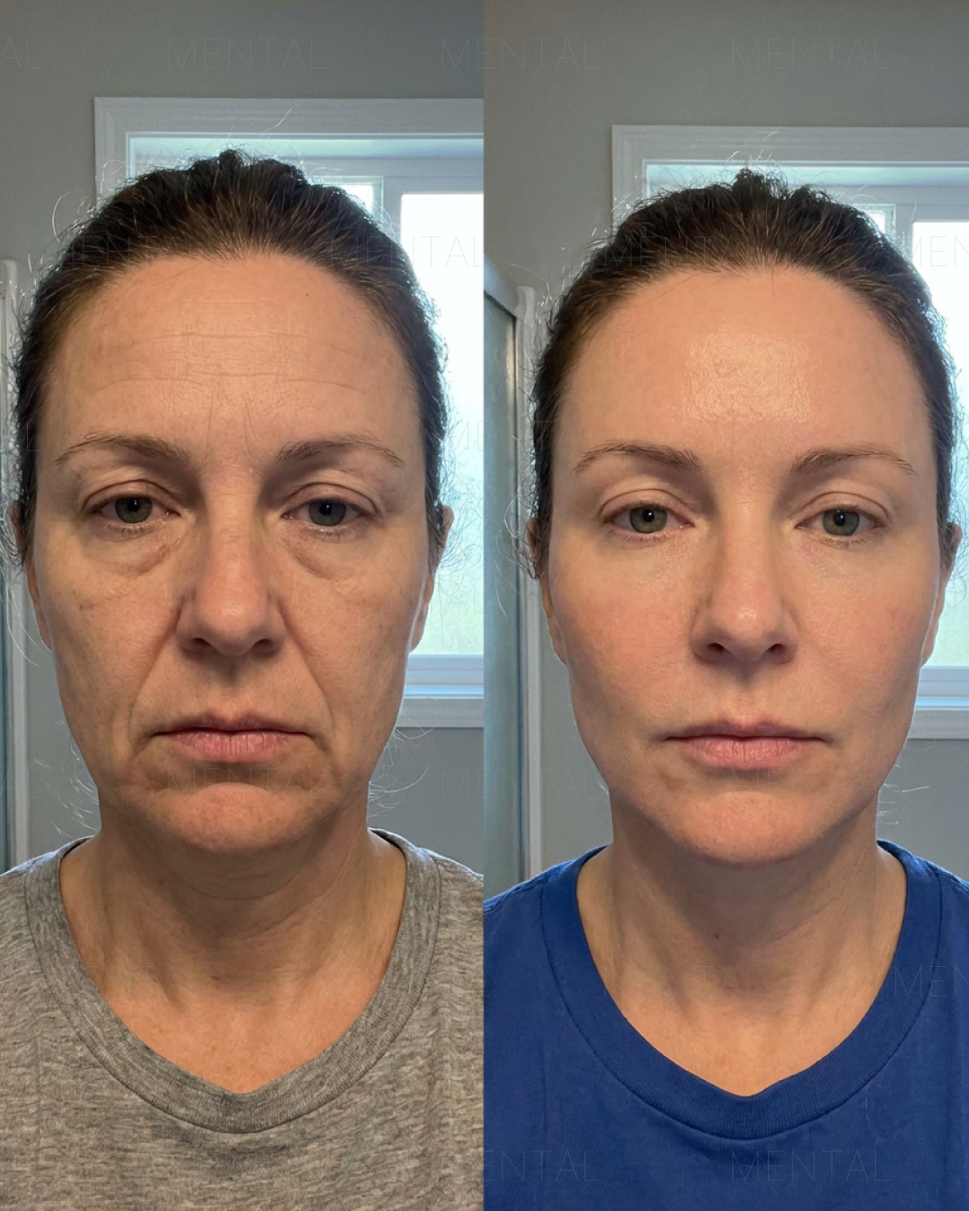 Mimika - Face Yoga Exercises Facebook ad