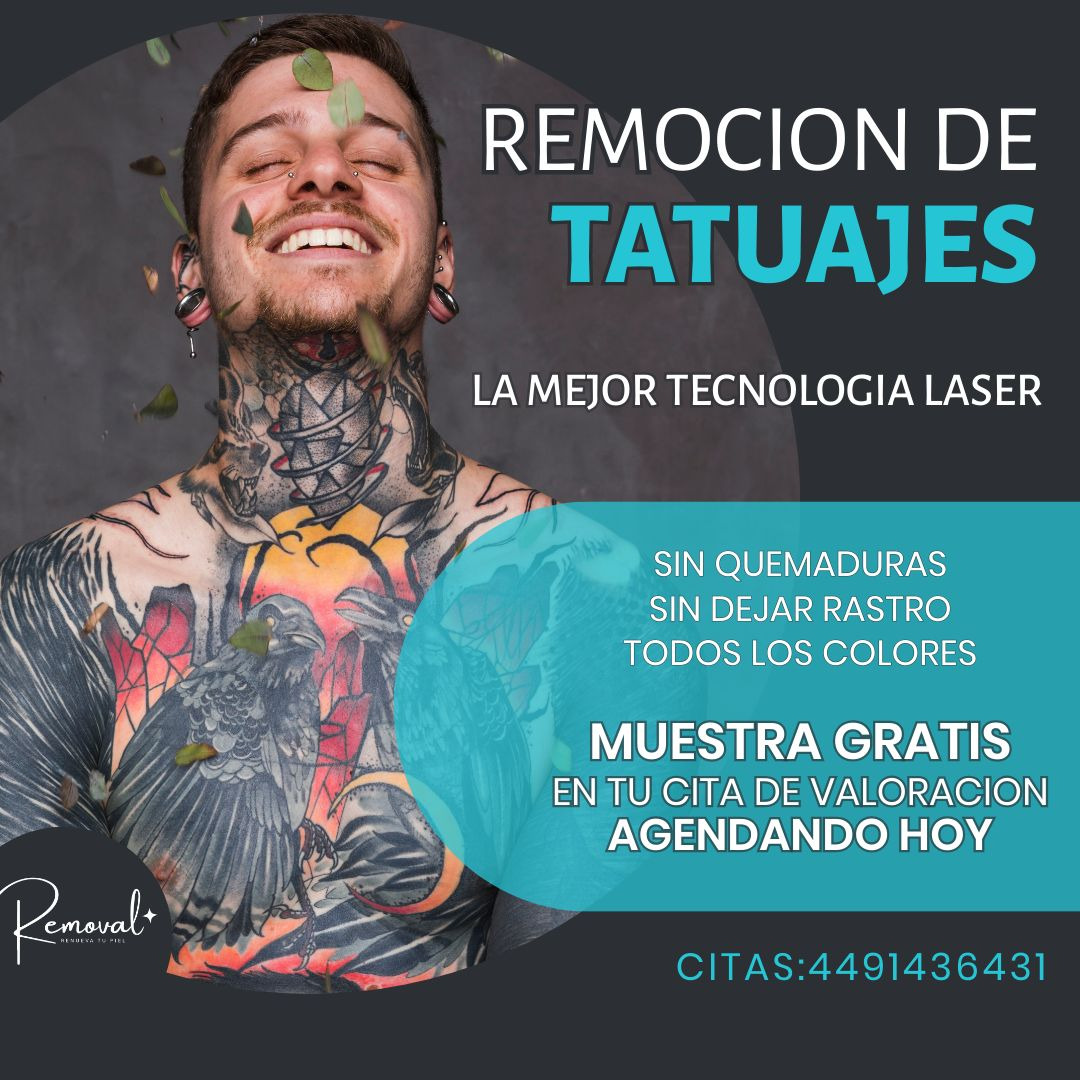 Removal Facebook ad: Agendar cita