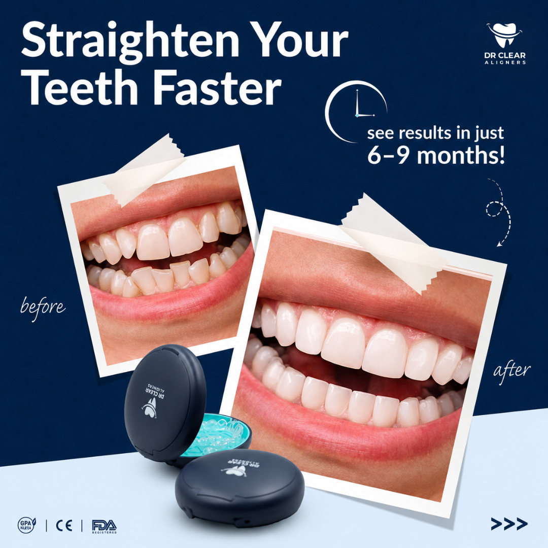 Dr Clear Aligners MY Facebook ad