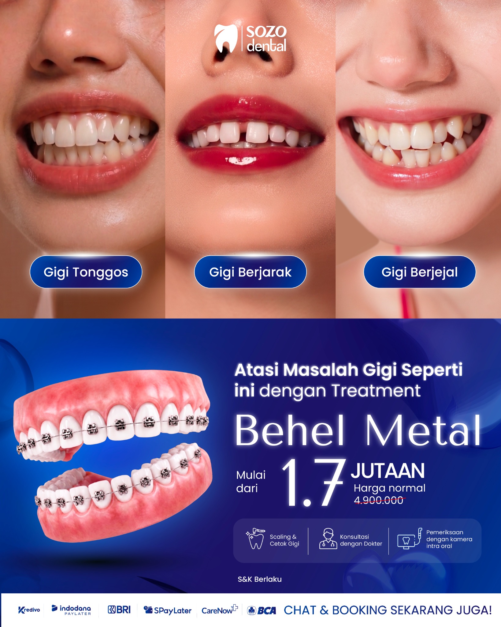 Sozo Dental Clinic Facebook ad: Promo Behel Sozo Dental