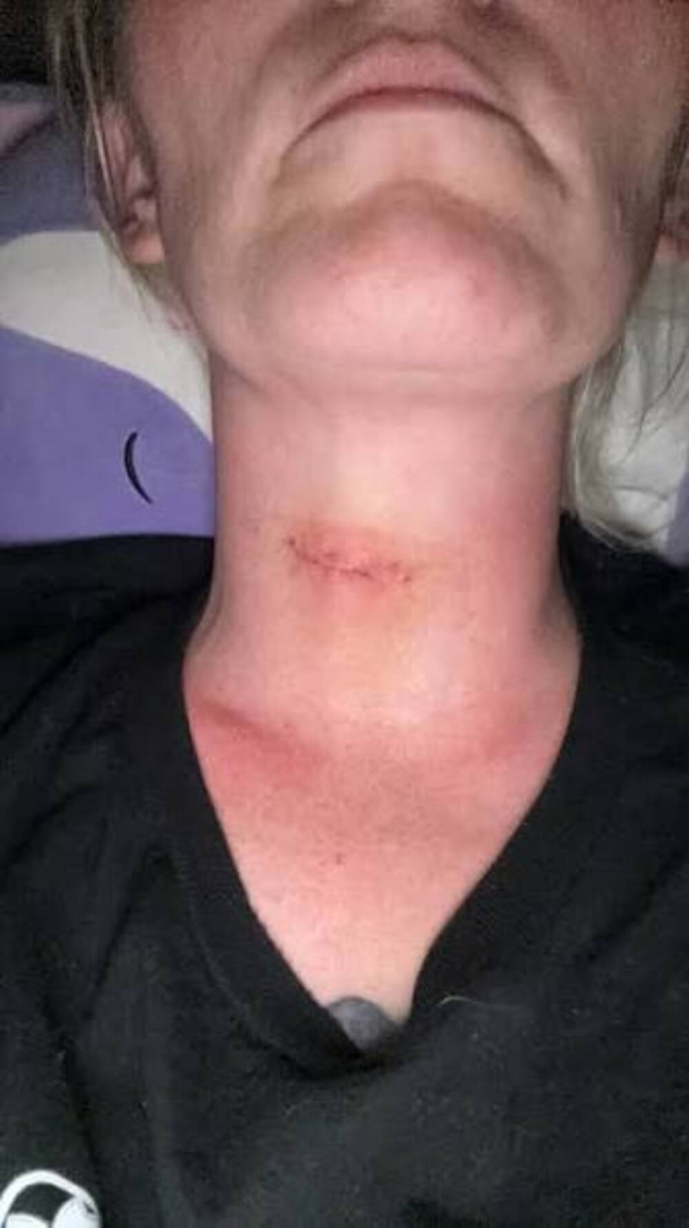 Dr. Marcus David Reynolds Facebook ad: I Found The Reason Why Your Thyroid Weight Won't Go Away