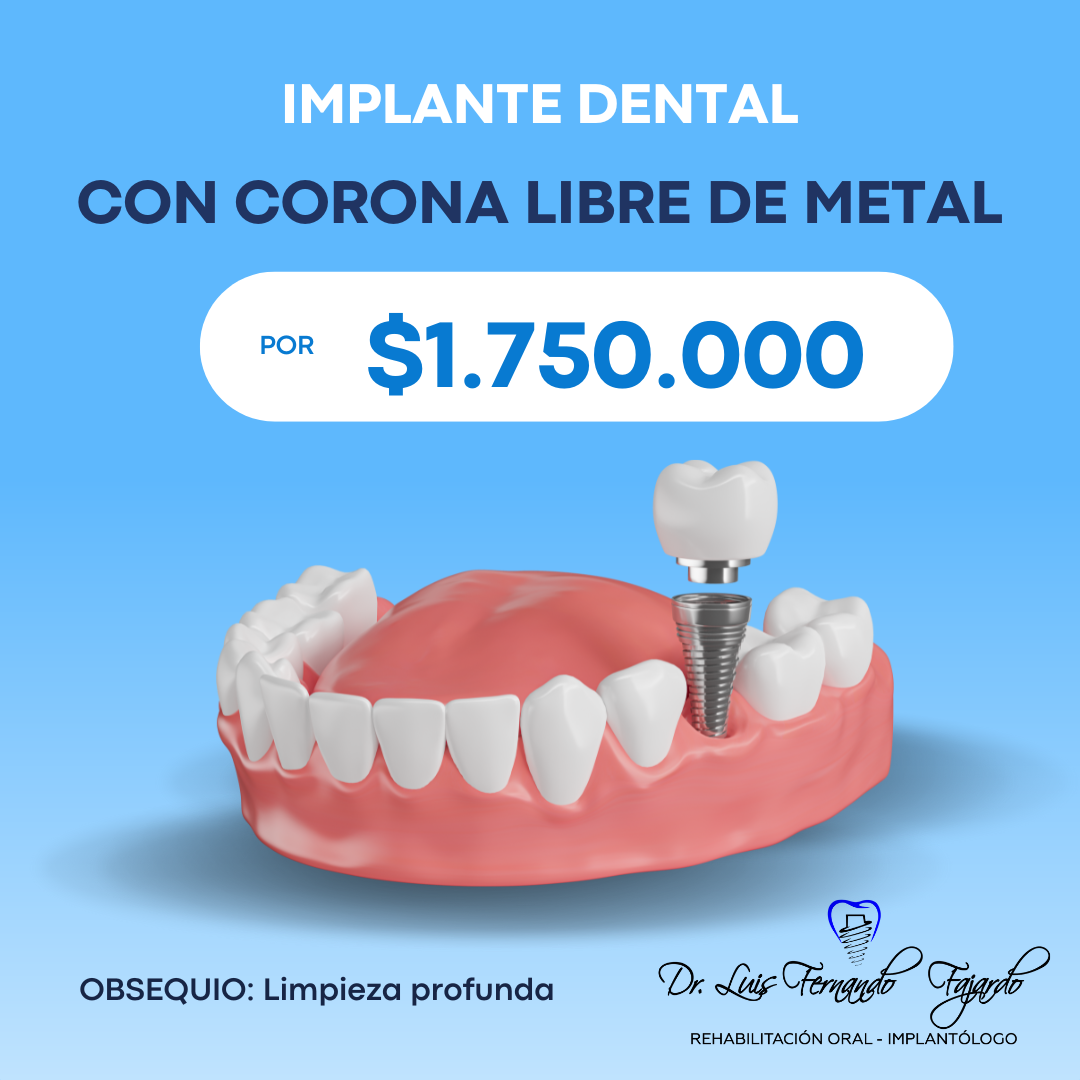 Dr Luis Fernando Fajardo Facebook ad: PROMOCIÓN IMPLANTE DENTAL