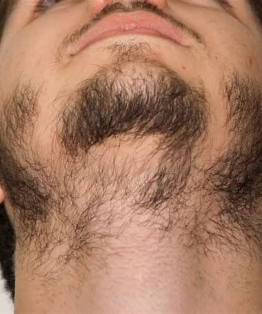 Marc Sturman Facebook ad: My Beard Looked Like Someone Had Given Up Halfway