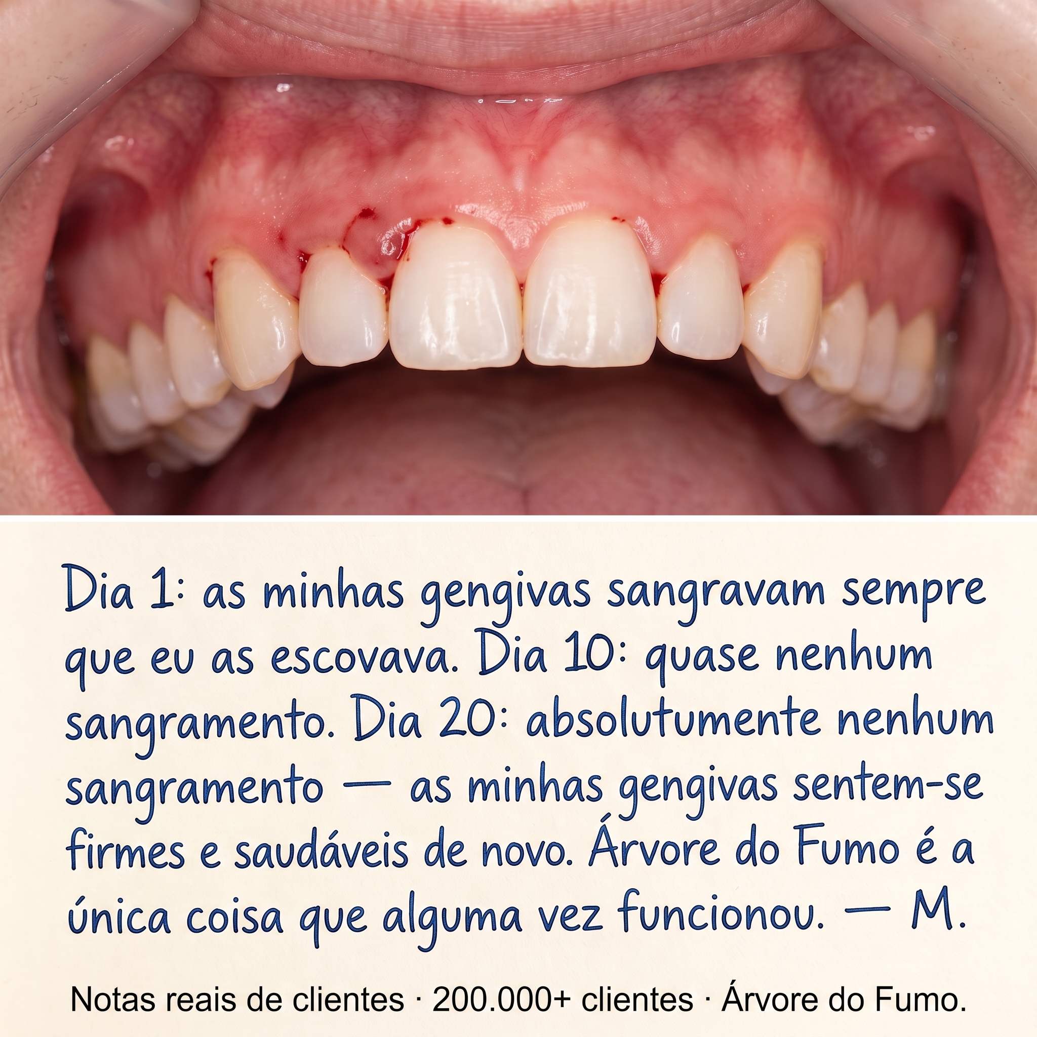 Cosméticos Orgânicos Familiares - InaEssentials.PT Facebook ad: Dia 20: as gengivas deixam de sangrar