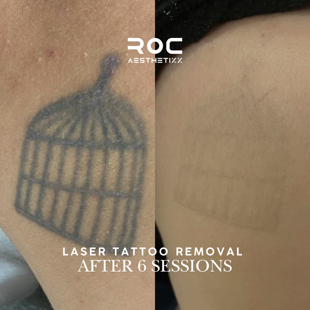 Roc Aesthetics Facebook ad