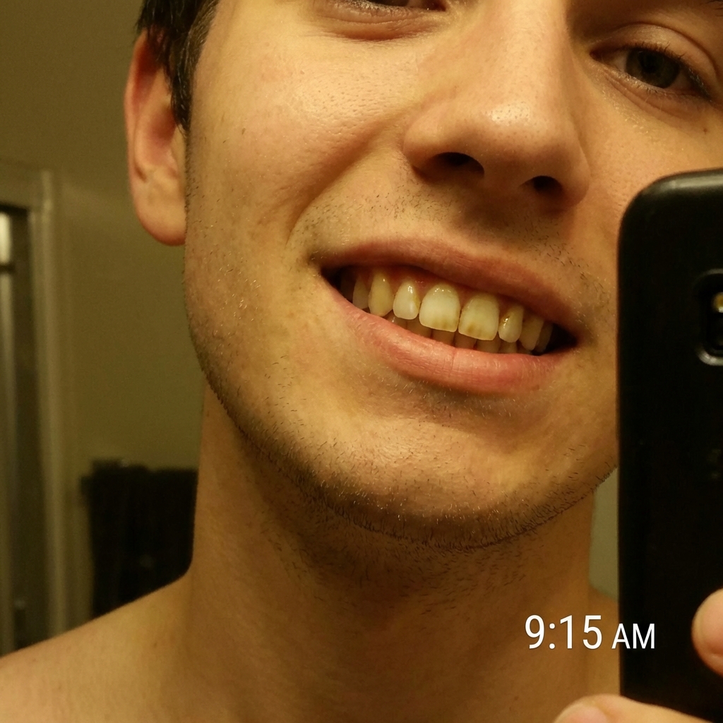 Chris Hill Facebook ad: Read this if you have yellow teeth