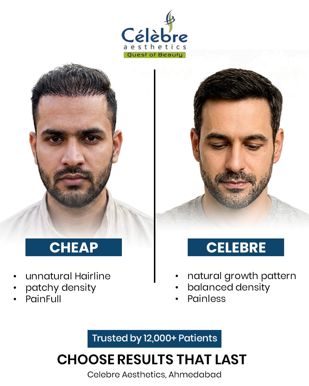 Celebre Aesthetics Facebook ad: Hair loss doesn't just take your hair.