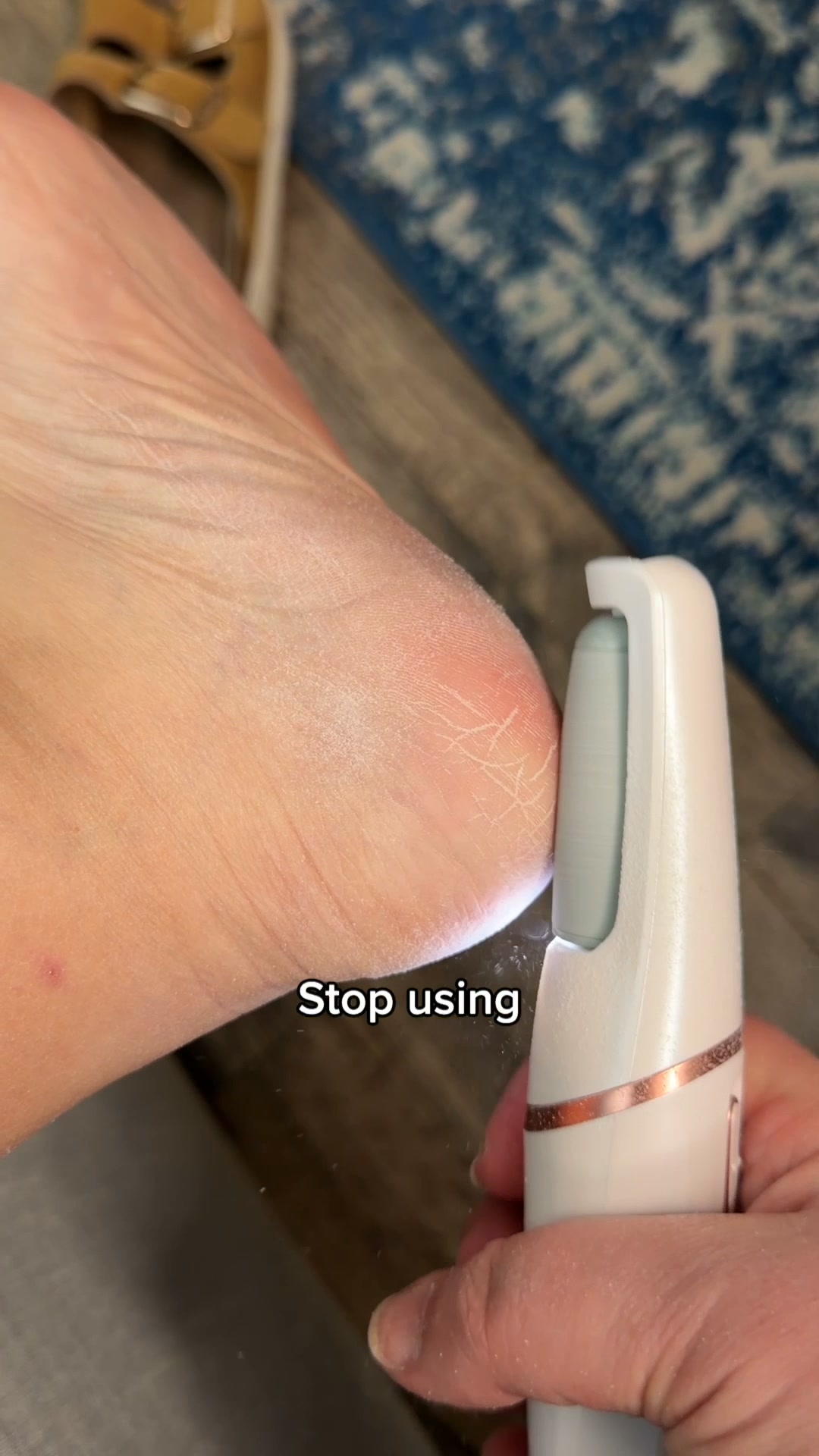 Nuvé Facebook ad: Baby soft feet in 5 minutes flat