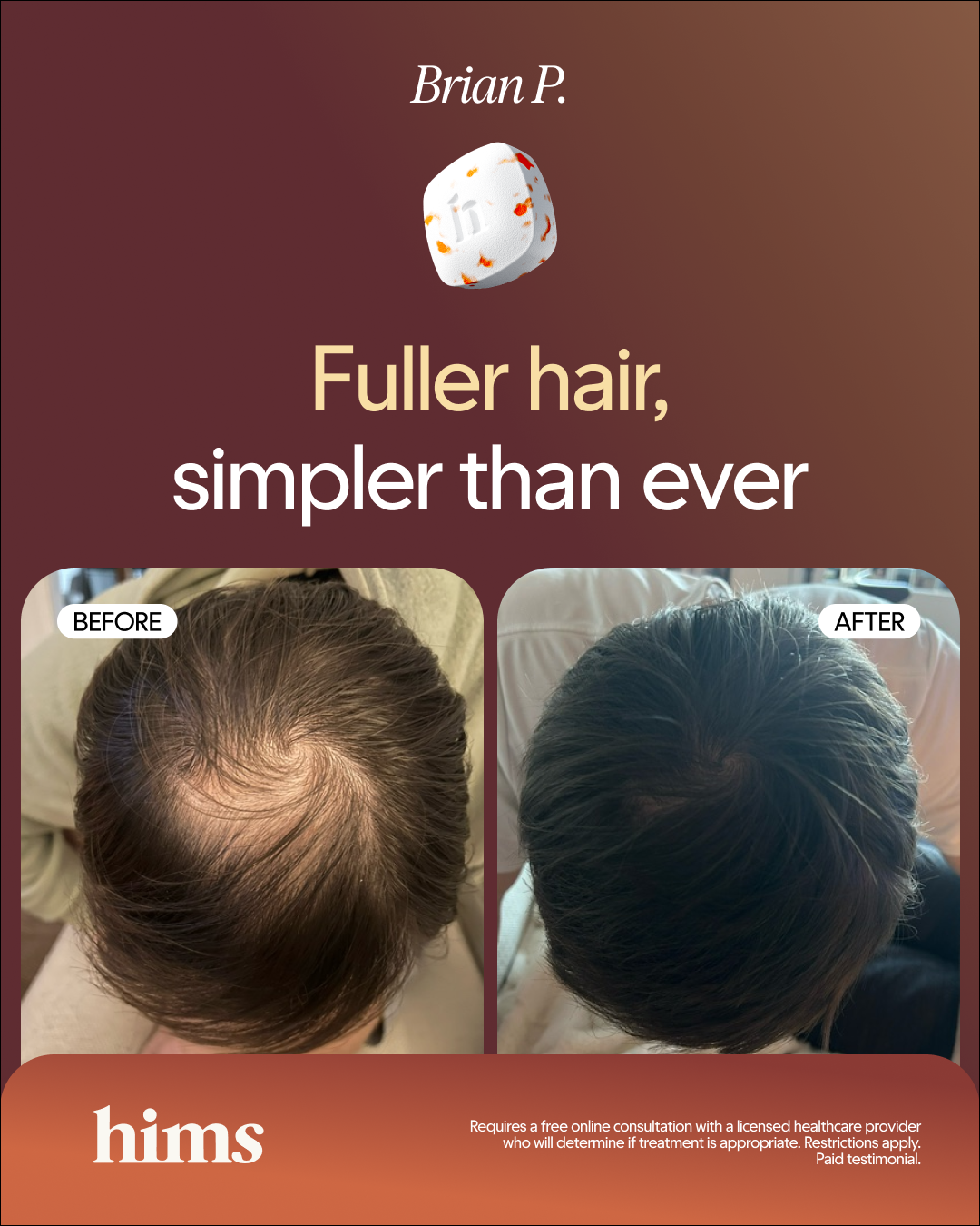 hims Facebook ad