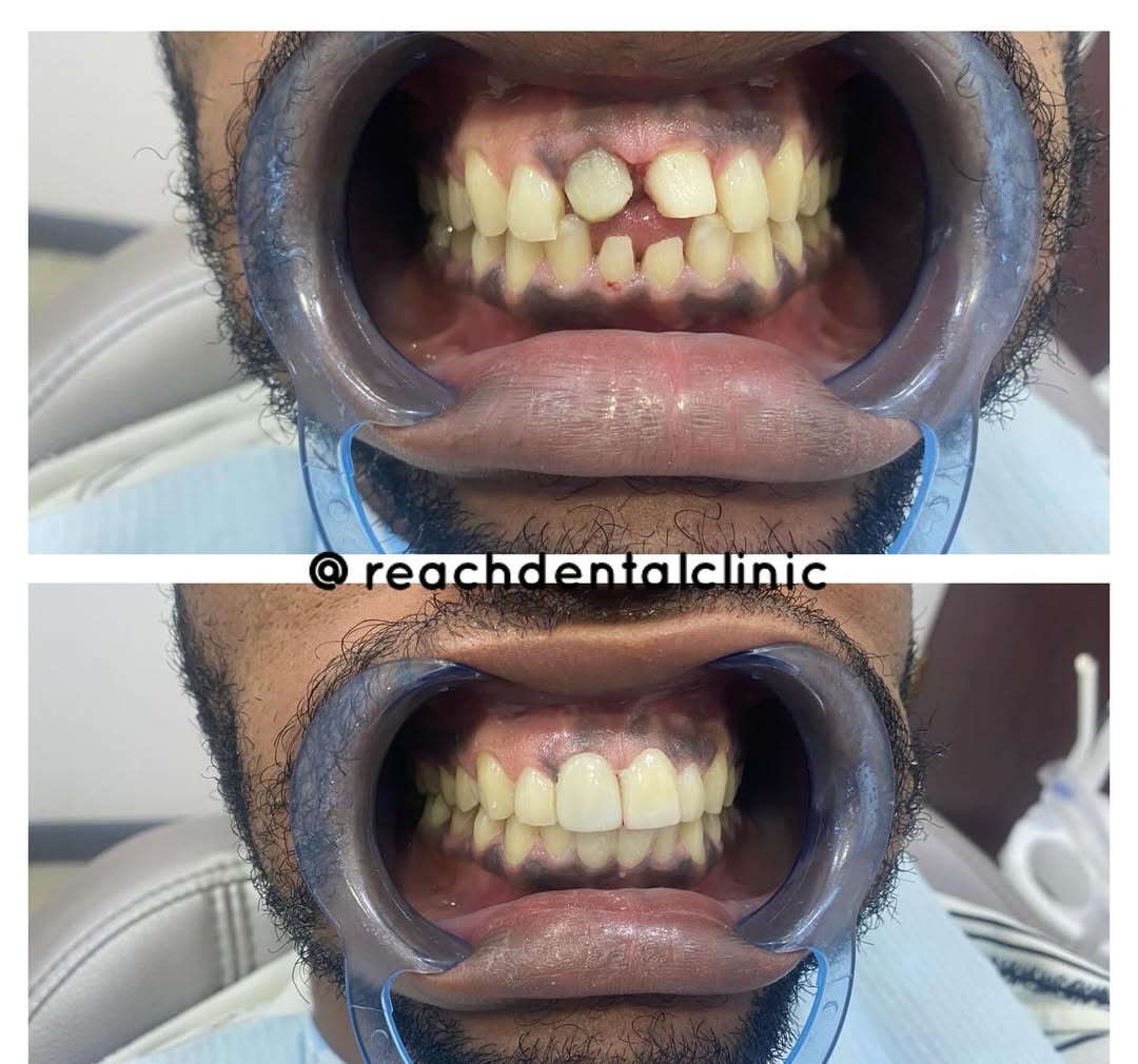 Reach Dental Orthodontics. Facebook ad