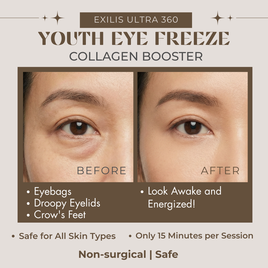 Bellezza Aesthetics Facebook ad