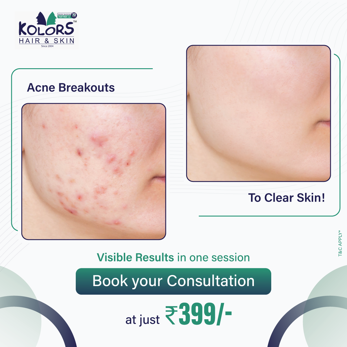 Kolors Hair and Skin Facebook ad