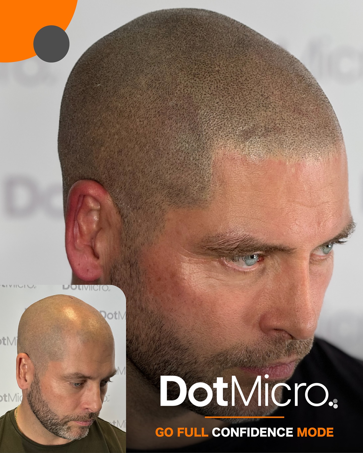 Dot Micro Facebook ad