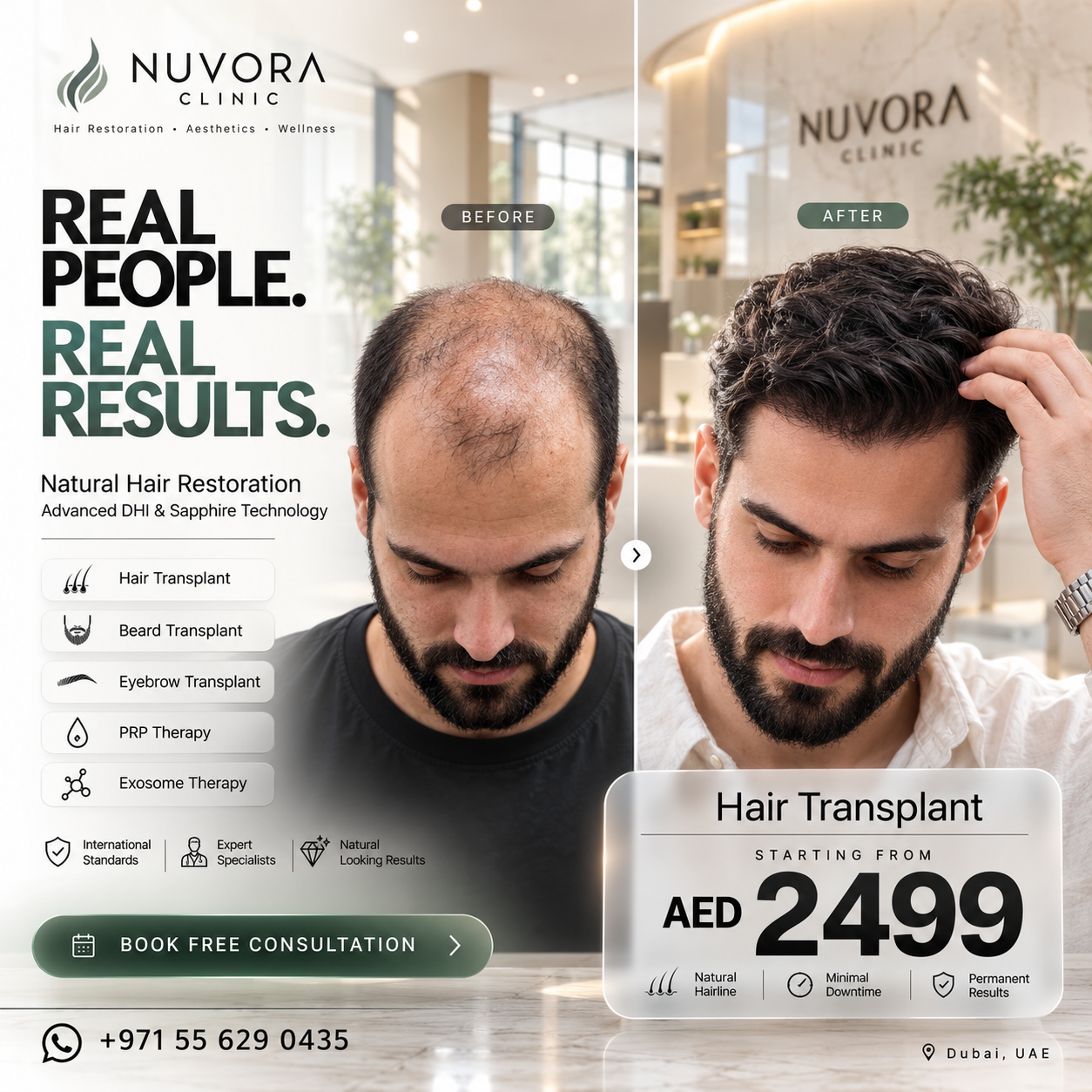 Nuvora clinic Facebook ad: Hair Transplant From 2499