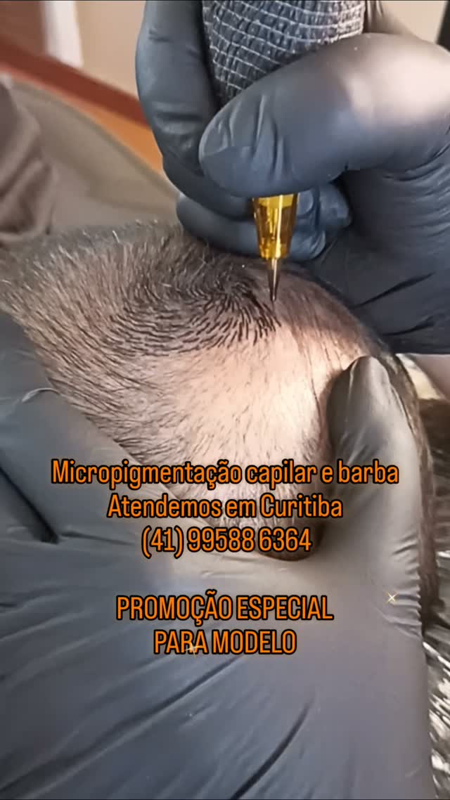 Paulo e Camila micropigmentação capilar Facebook ad: Mude de vez seu visual!