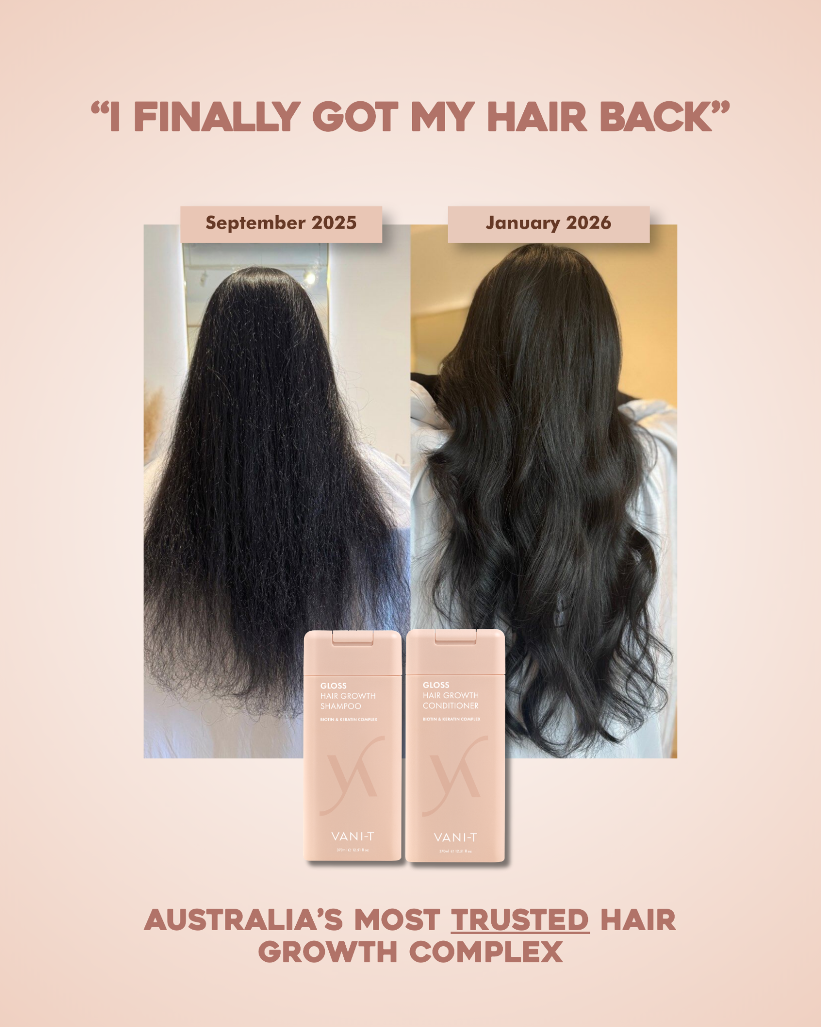 VANI-T Facebook ad: I Finally Got My Hair Back