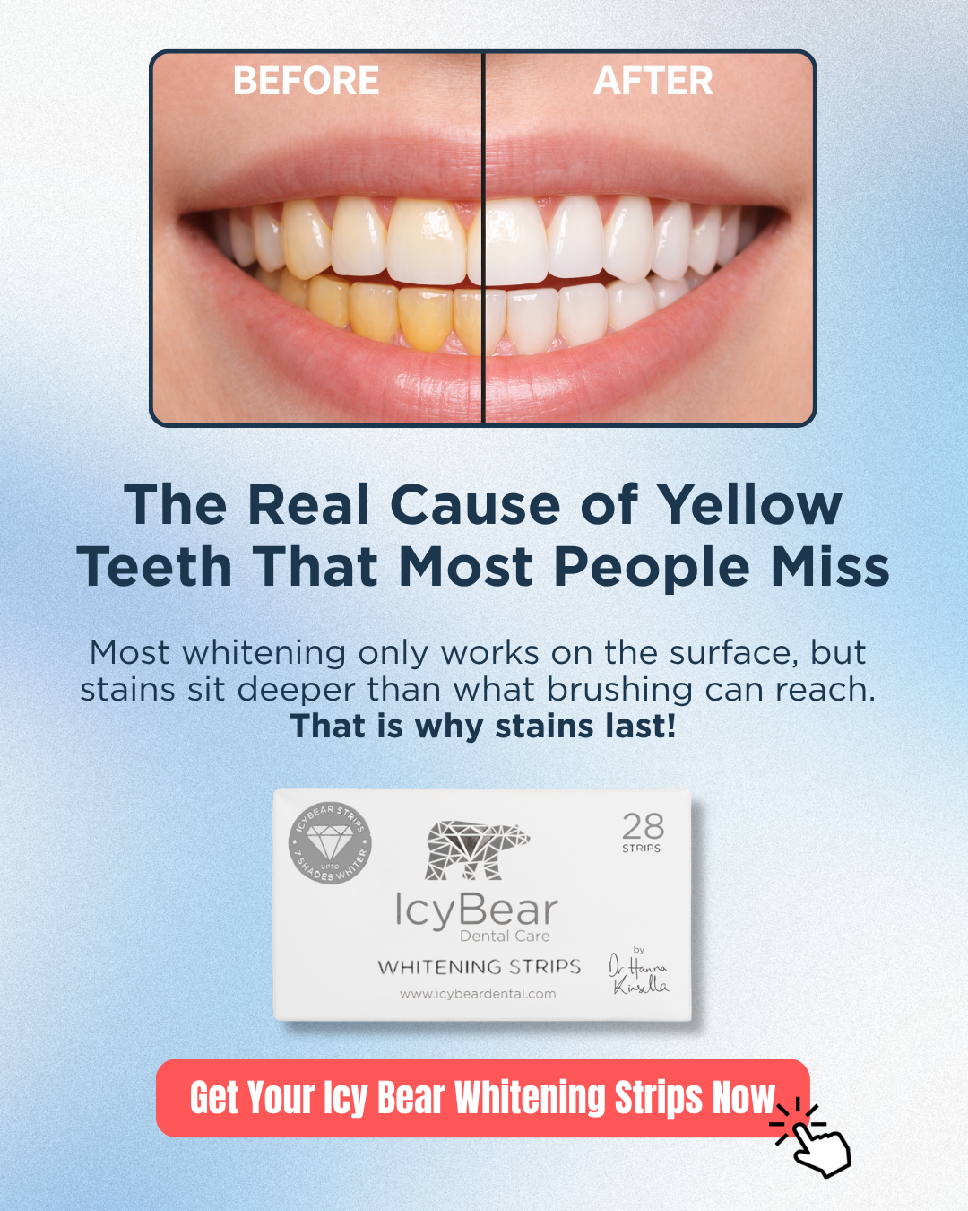 Icy Bear Dental Facebook ad