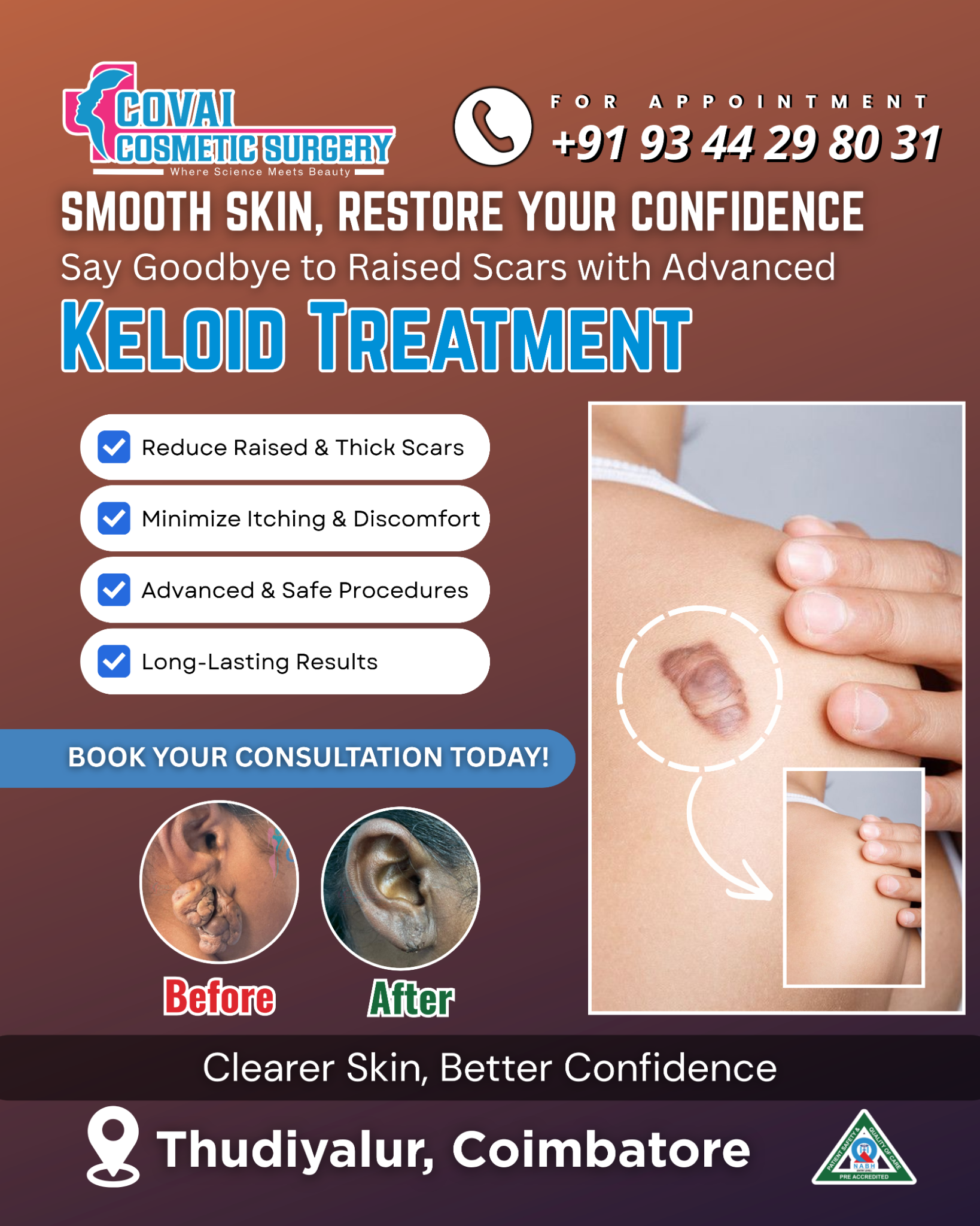 Covai Cosmetic Surgery Facebook ad: Remove Raised Scars Safely