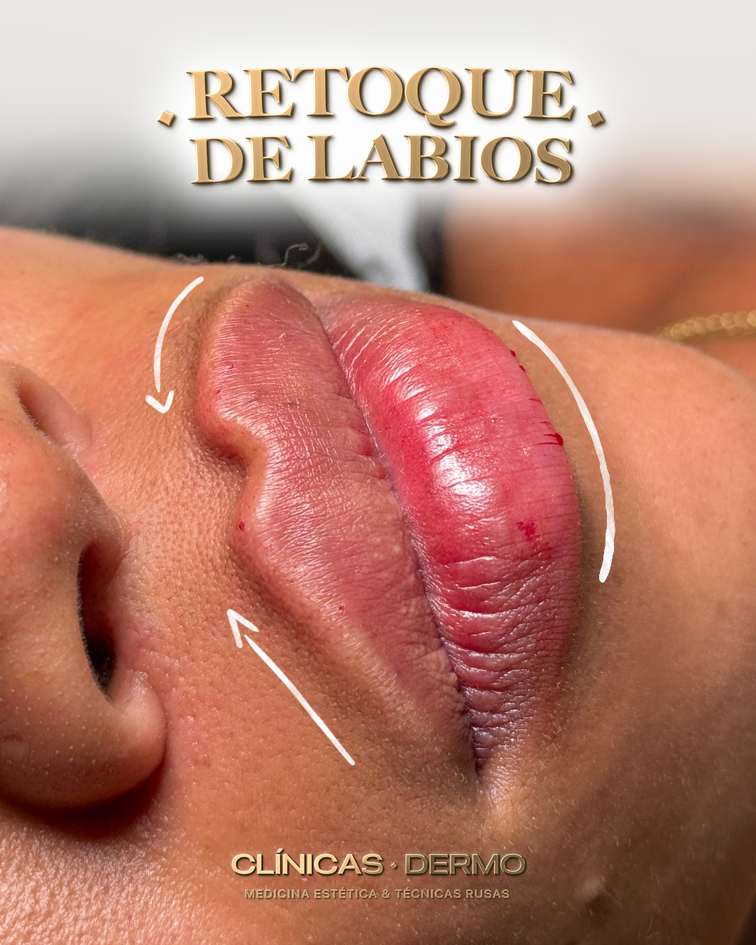 Dermo Clinic Chorbadzhyiiska Facebook ad