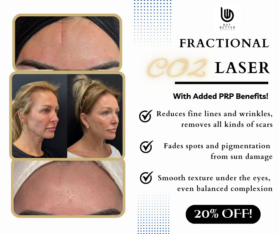 Way Better Laser Clinic Facebook ad: 20% OFF CO2 Laser Resurfacing + PRP