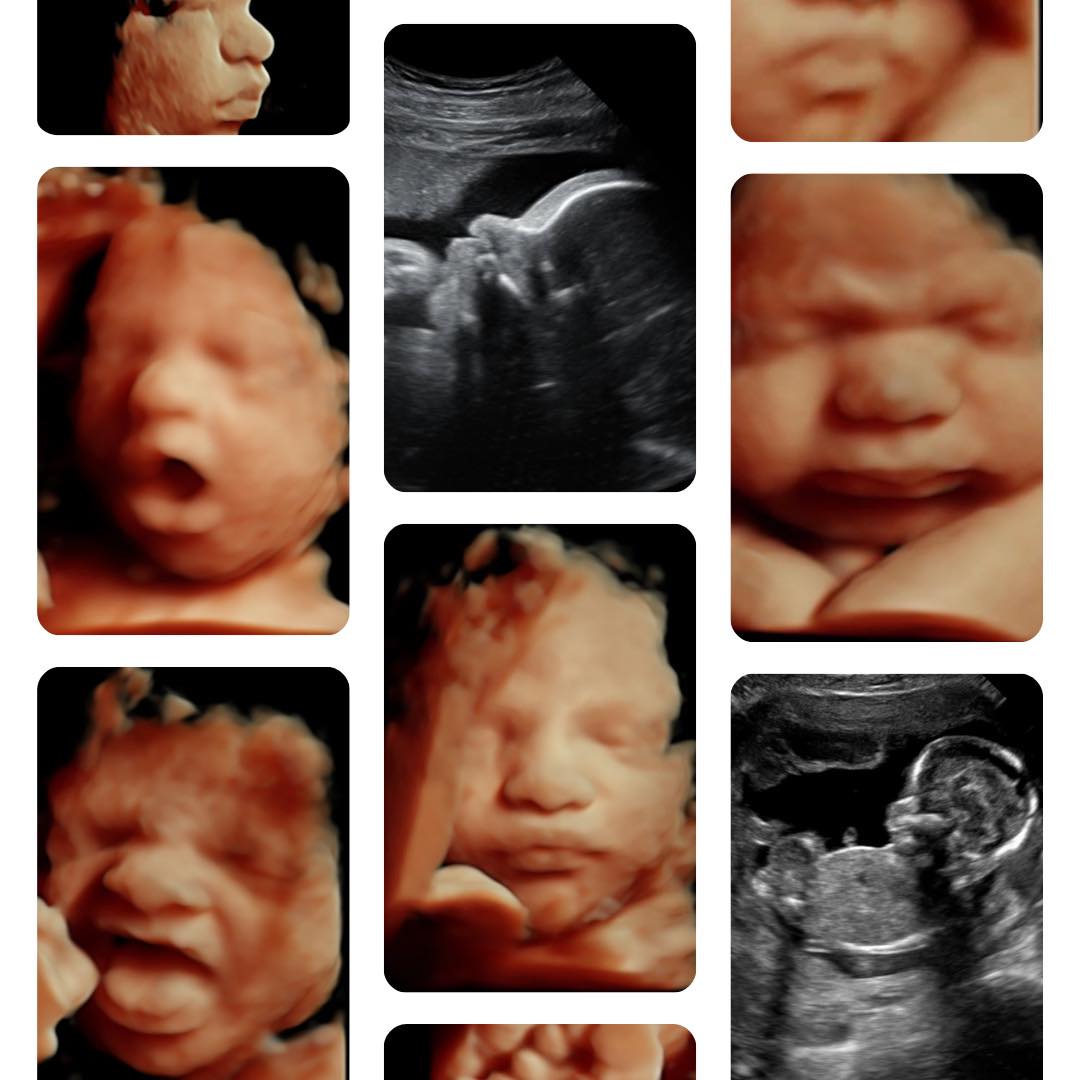 Pacific Northwest Peeks 3D/4D Ultrasound Facebook ad: Meet Your Baby in Stunning Detail at Kitsap…