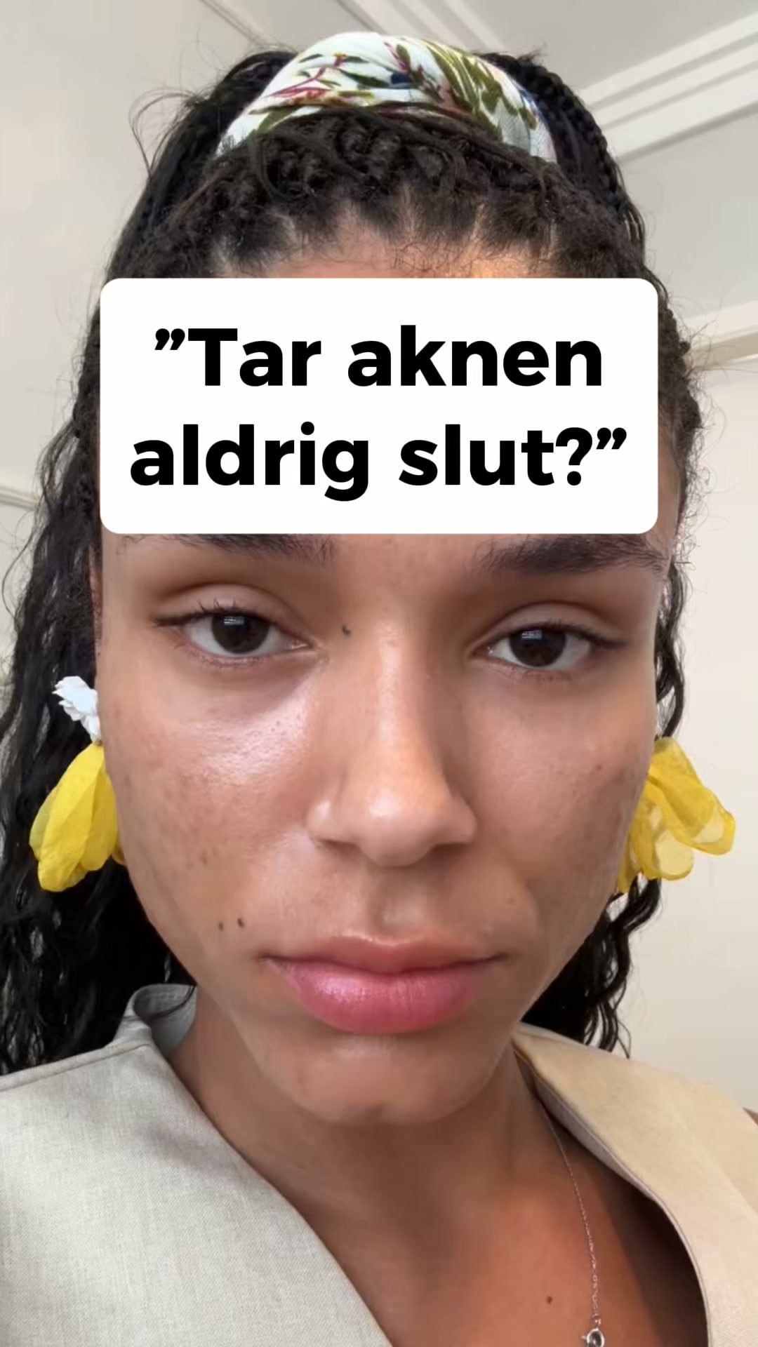 LovieBaby Facebook ad: Naturlig hudvård för akne
