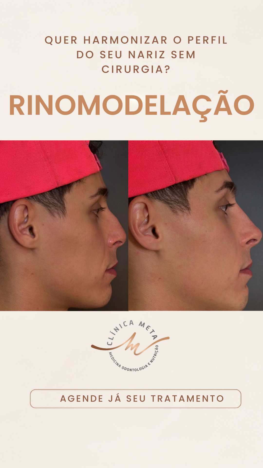 Clínica META - Medicina Integrativa e Estética Facebook ad from Jul 7, 2026