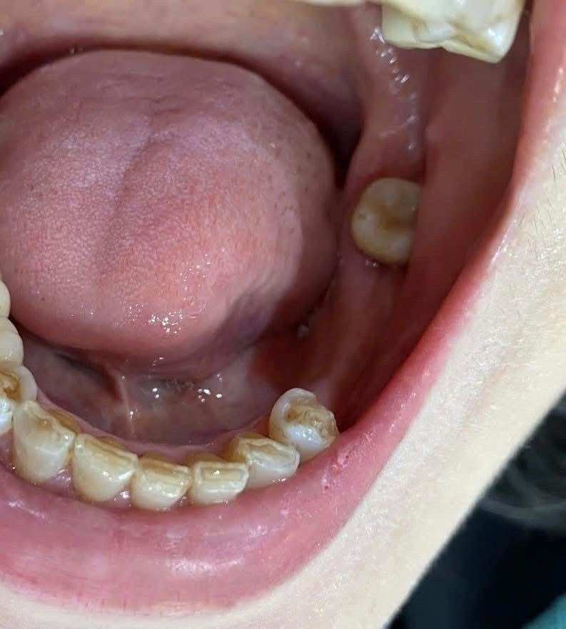 Delia Dental Clinic Facebook ad