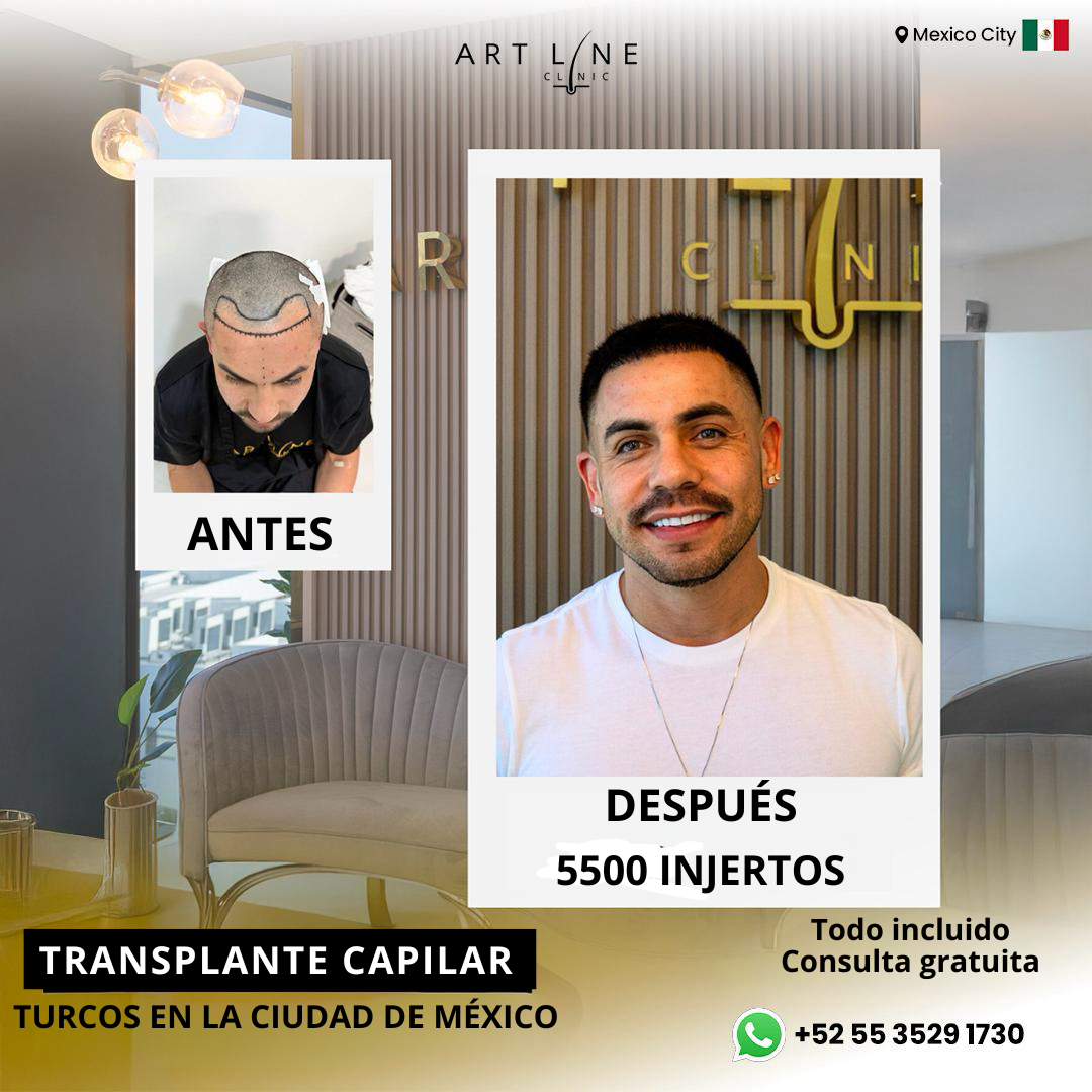 Art Line Hair Clinic CDMX Facebook ad: Agenda tu valoración