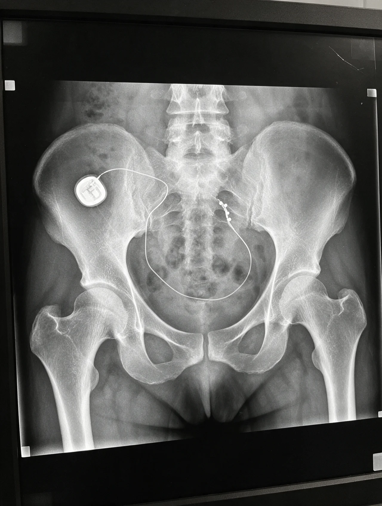 Dr. Patricia Sullivan Facebook ad: Your bladder lied to you every single hour