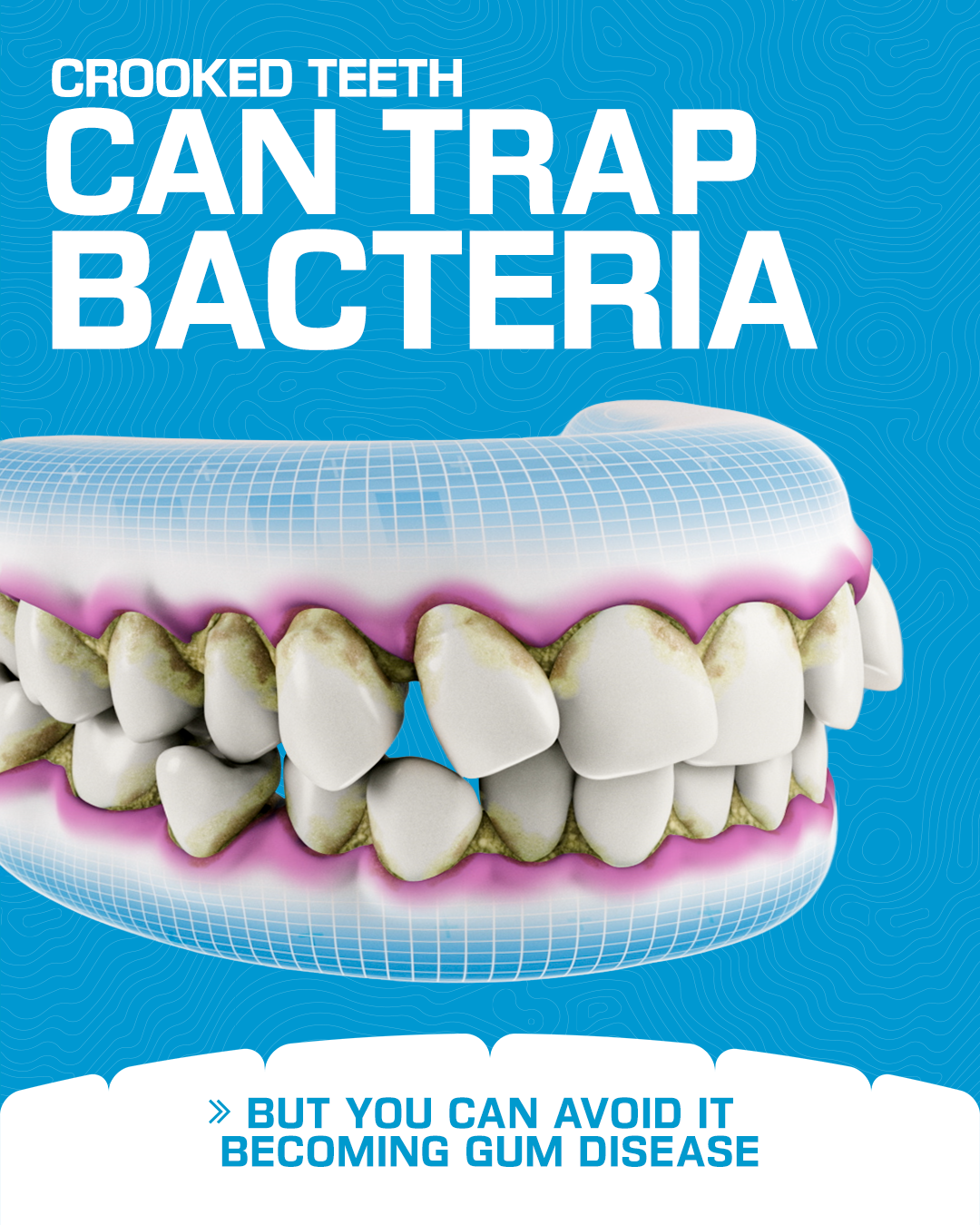 Invisalign Facebook ad