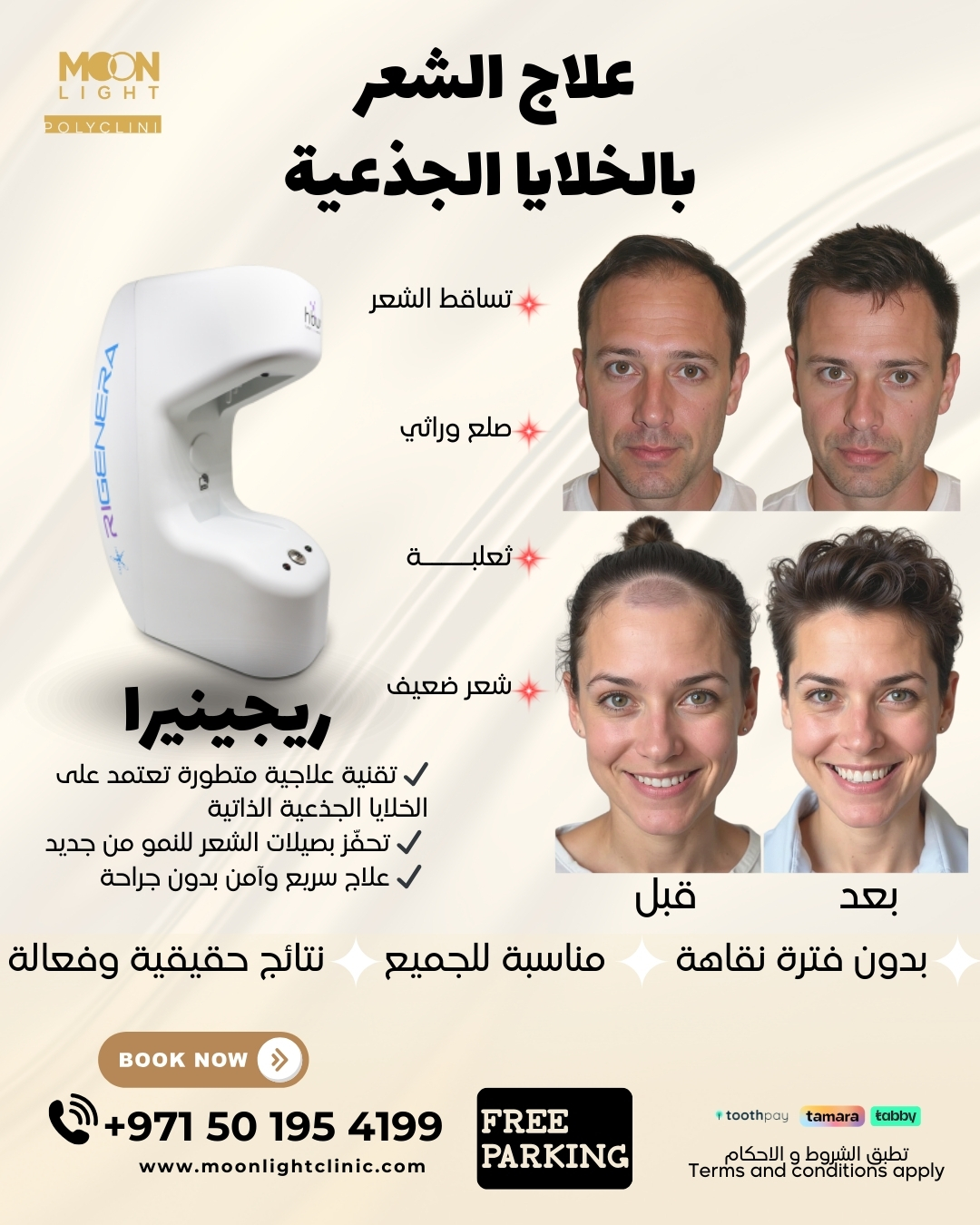Moonlight-Polyclinic Facebook ad: **وداعًا لتساقط الشعر مع تقنية ريجينيرا المتطورة!**