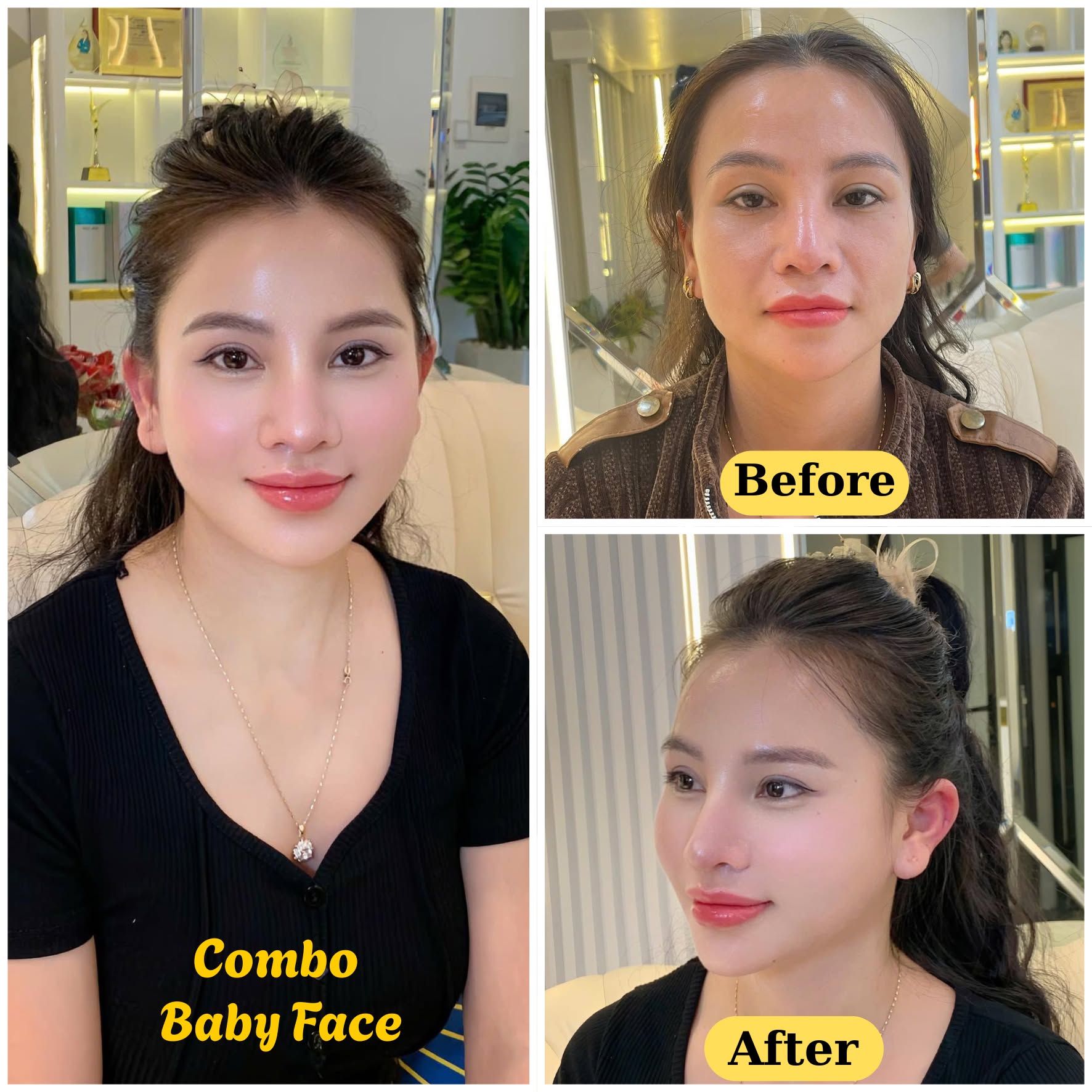 Korean Skin Rejuvenation Technology Facebook ad