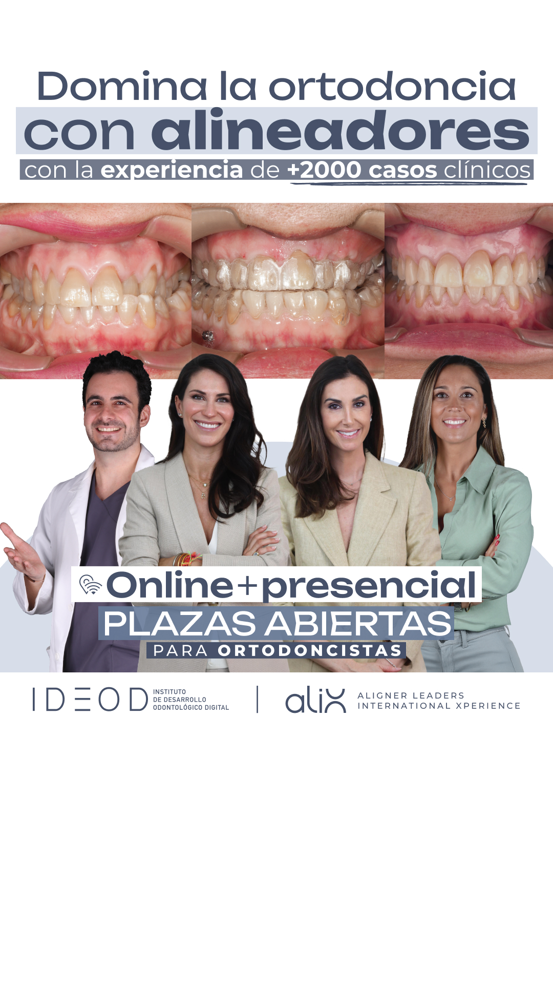 Instituto IDEOD Facebook ad: Domina los alineadores con +2.000 casos de experiencia